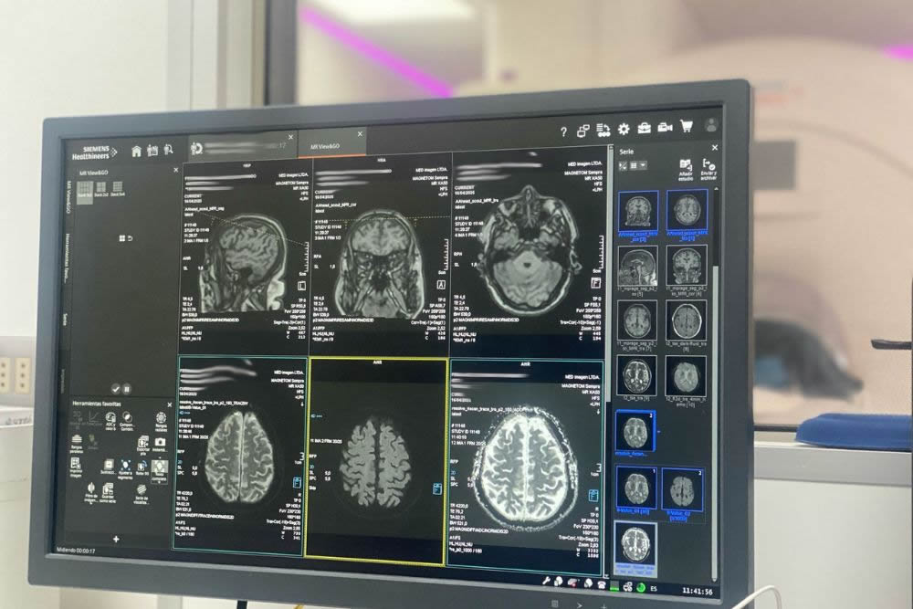 Neurología & EEG